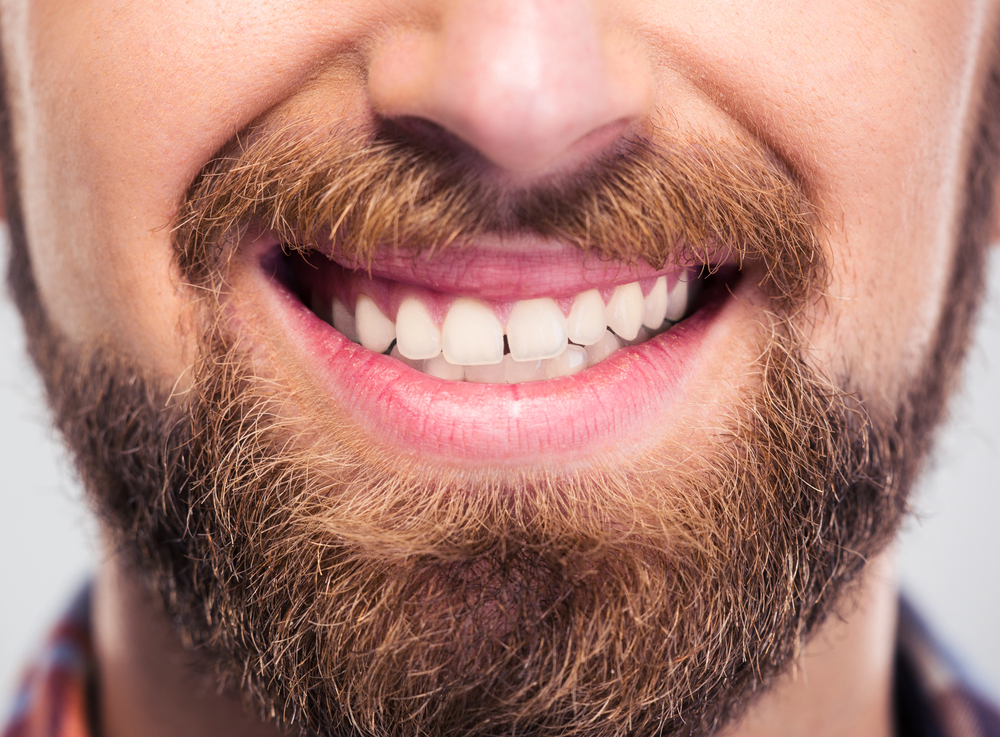 Tooth exposure and bond for orthodontic treatment